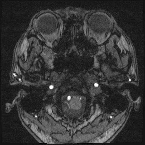 Click on the Serie image to view the images of VILLANUEVA, WILLIAM A.